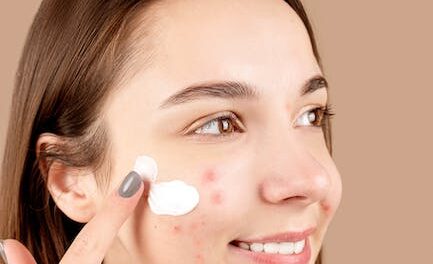 Make Pimples A Subject Put To Rest