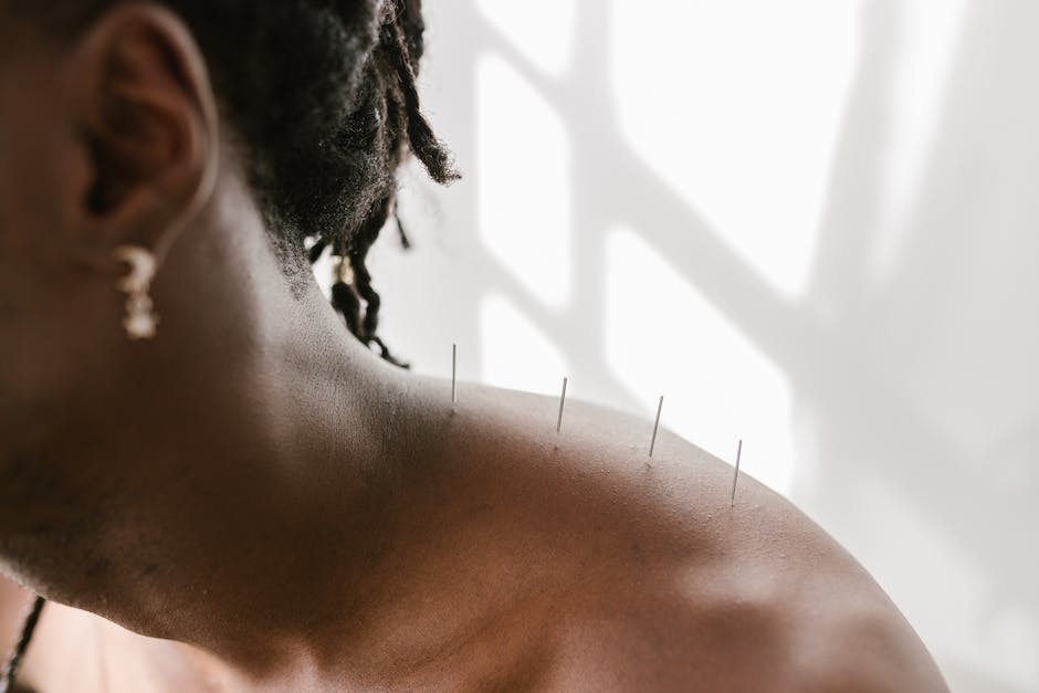 Why Acupuncture Works Well Along With Other Information