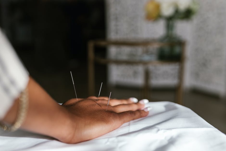 The Most Effective Acupuncture Recommendations You Will Find