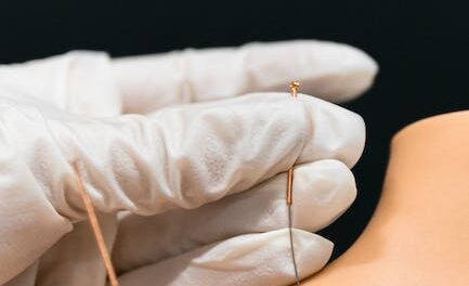 Acupuncture Along With Your Wellness — What You Must Know