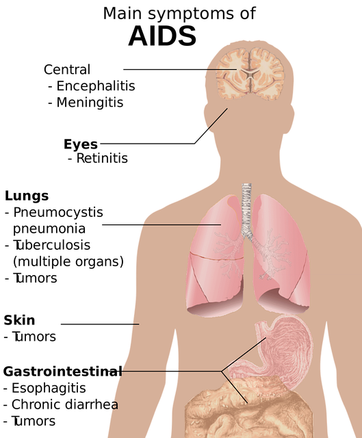 Study These Pointers About Acid Reflux Disease Disease.